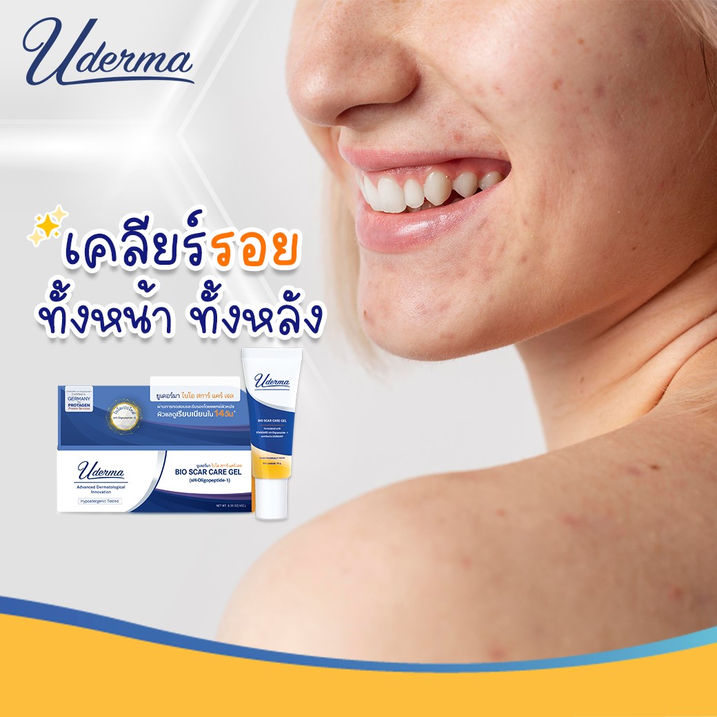 Uderma, Uderma รีวิว, Uderma ราคา, Uderma Bio Scar Care Gel, Uderma Bio Scar Care Gel รีวิว, Uderma Bio Scar Care Gel ราคา, Uderma Bio Scar Care Gel 10g, Uderma Bio Scar Care Gel 10g เจลบำรุง, Uderma Bio Scar Care Gel หลุมสิว, 